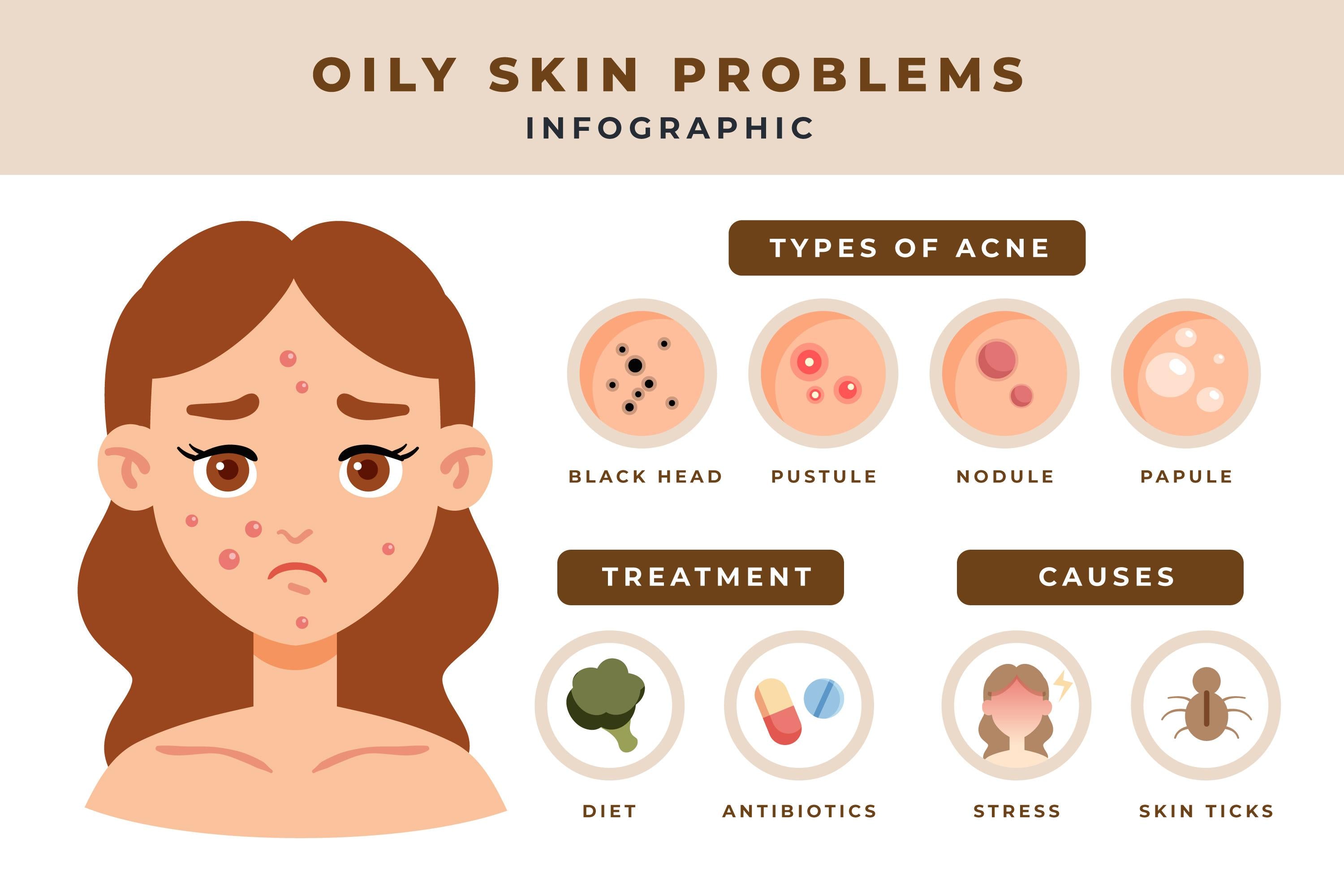 Best Skincare Regime to Combat Oily Skin